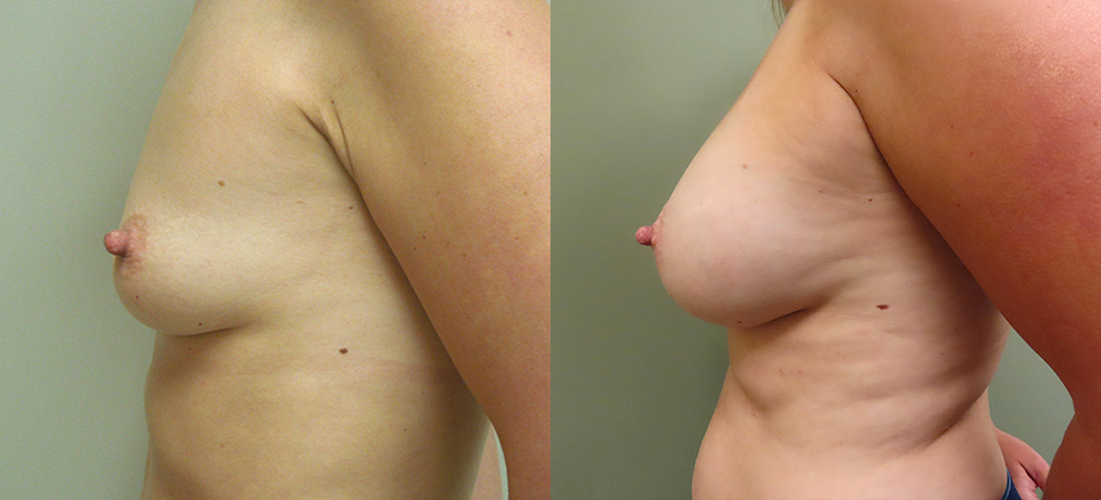 Real patient results in Owings Mills, MD Performed by Steven J. Rottman MD