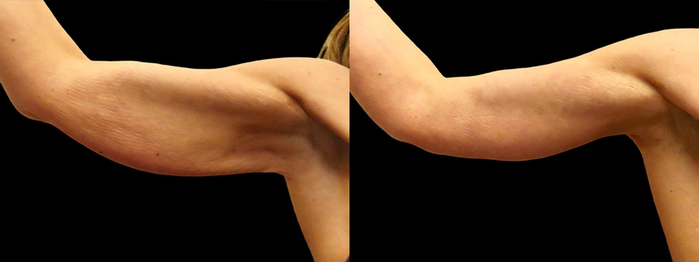 Real patient results in Owings Mills, MD Performed by Steven J. Rottman MD