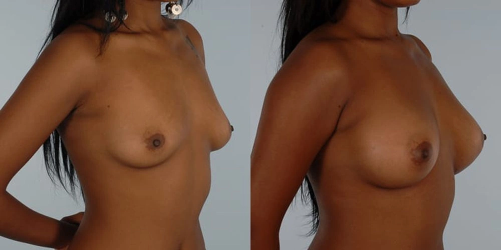 Real patient results in Owings Mills, MD Performed by Steven J. Rottman MD