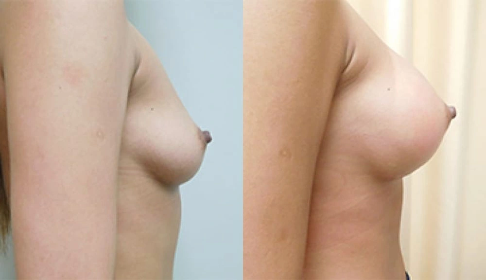 Real patient results in Owings Mills, MD Performed by Steven J. Rottman MD