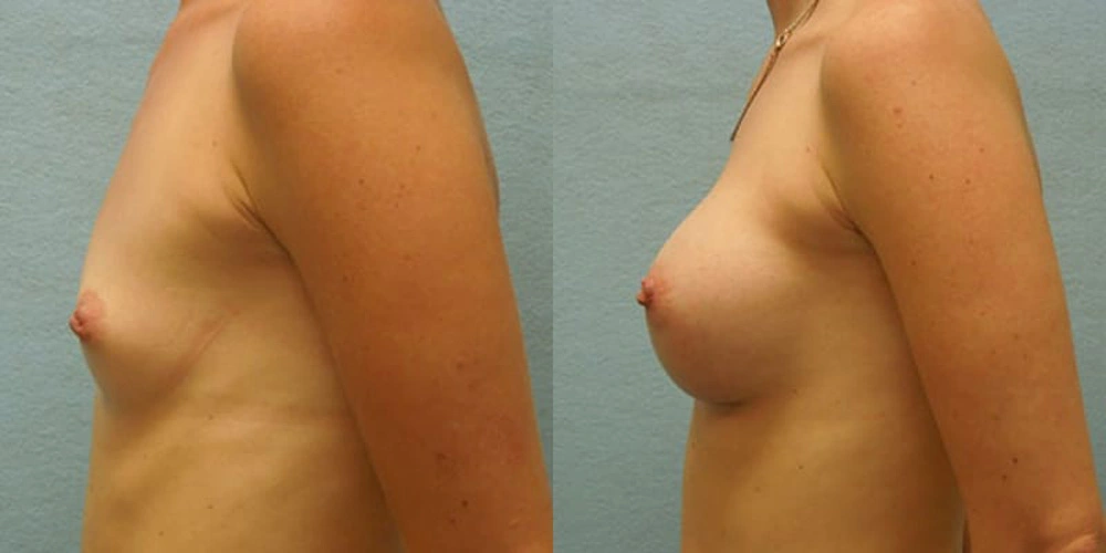 Real patient results in Owings Mills, MD Performed by Steven J. Rottman MD