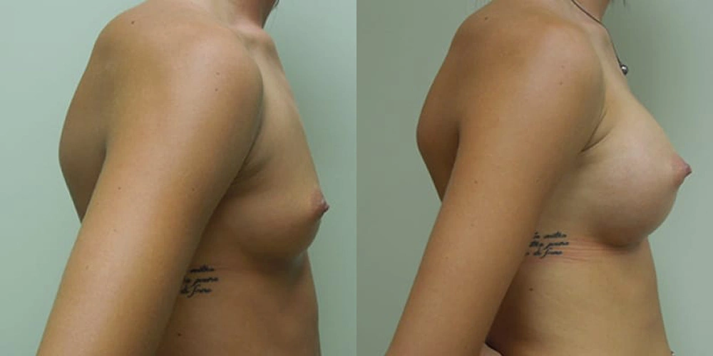 Real patient results in Owings Mills, MD Performed by Steven J. Rottman MD