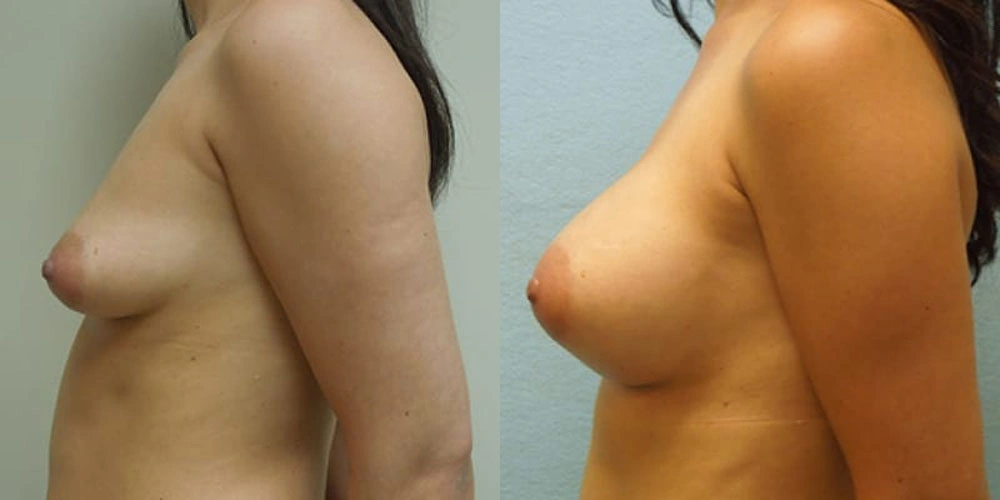 Real patient results in Owings Mills, MD Performed by Steven J. Rottman MD
