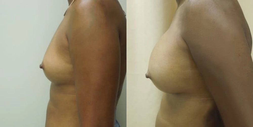 Real patient results in Owings Mills, MD Performed by Steven J. Rottman MD