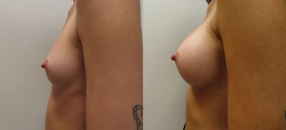 Real patient results in Owings Mills, MD Performed by Steven J. Rottman MD