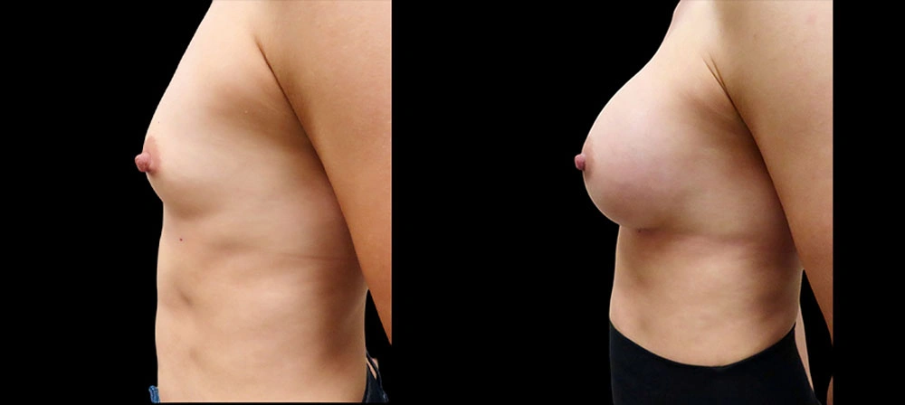 Real patient results in Owings Mills, MD Performed by Steven J. Rottman MD