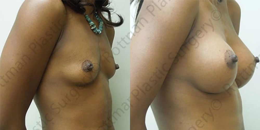Real patient results in Owings Mills, MD Performed by Steven J. Rottman MD