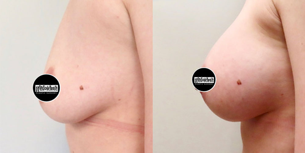 Real patient results in Owings Mills, MD Performed by Steven J. Rottman MD