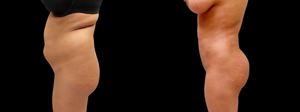 Real patient results in Owings Mills, MD Performed by Steven J. Rottman MD