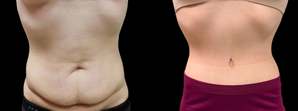 Real patient results in Owings Mills, MD Performed by Steven J. Rottman MD