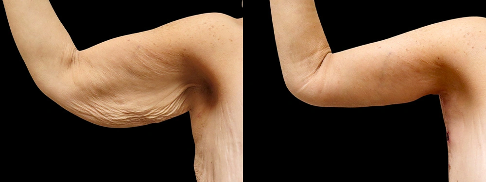 Real patient results in Owings Mills, MD Performed by Steven J. Rottman MD