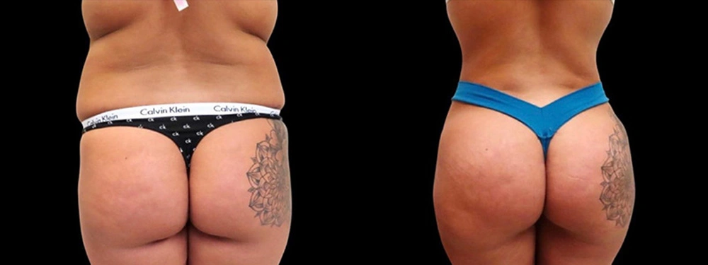 Real patient results in Owings Mills, MD Performed by Steven J. Rottman MD