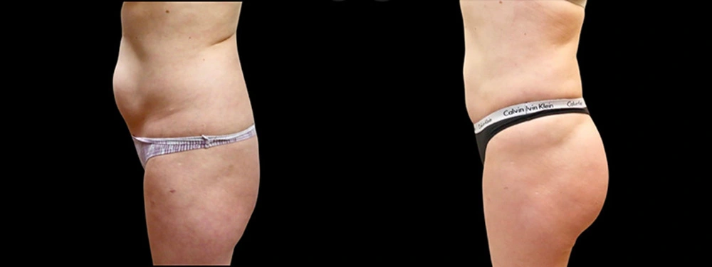 Real patient results in Owings Mills, MD Performed by Steven J. Rottman MD
