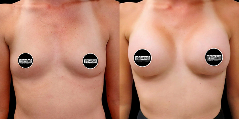 Real patient results in Owings Mills, MD Performed by Steven J. Rottman MD
