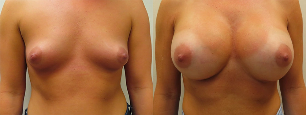 Real patient results in Owings Mills, MD Performed by Steven J. Rottman MD