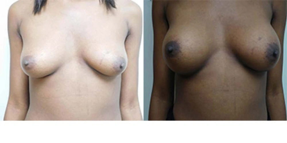 Real patient results in Owings Mills, MD Performed by Steven J. Rottman MD