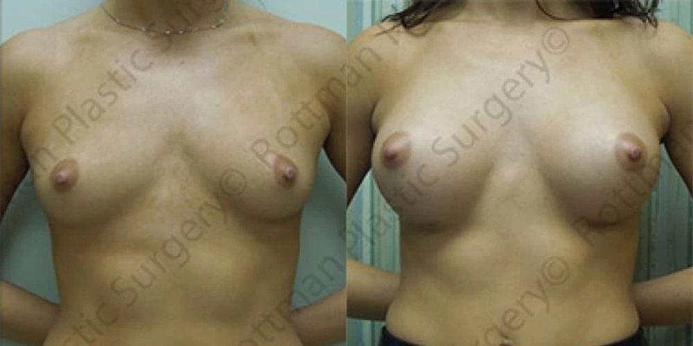 Real patient results in Owings Mills, MD Performed by Steven J. Rottman MD