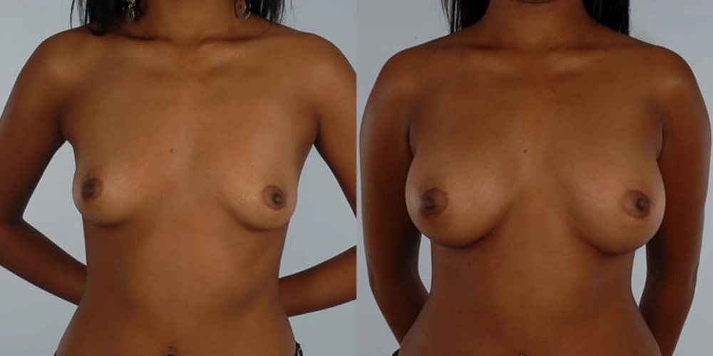 Real patient results in Owings Mills, MD Performed by Steven J. Rottman MD