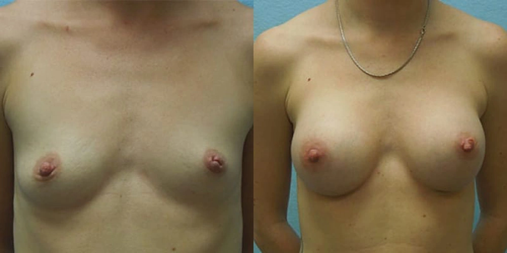 Real patient results in Owings Mills, MD Performed by Steven J. Rottman MD