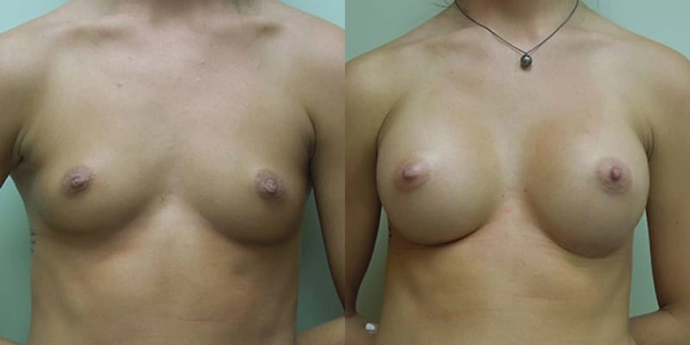 Real patient results in Owings Mills, MD Performed by Steven J. Rottman MD