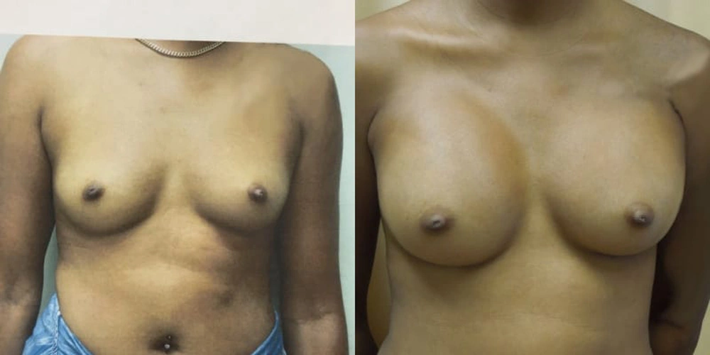 Real patient results in Owings Mills, MD Performed by Steven J. Rottman MD