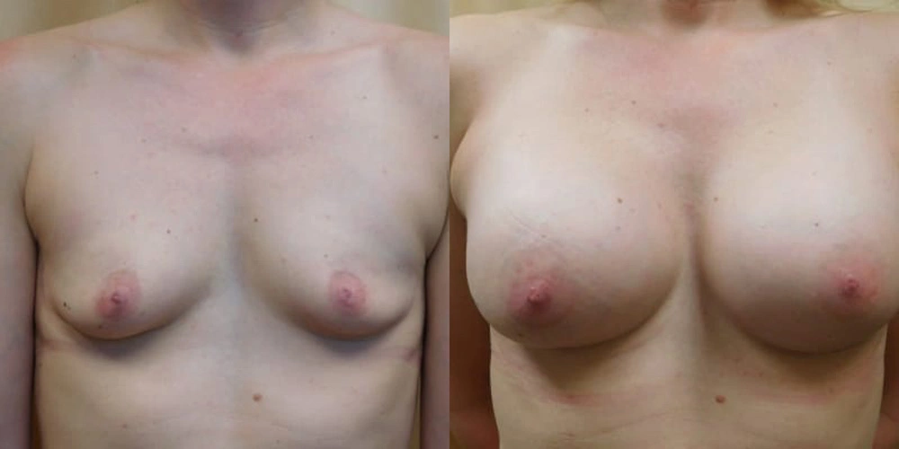 Real patient results in Owings Mills, MD Performed by Steven J. Rottman MD
