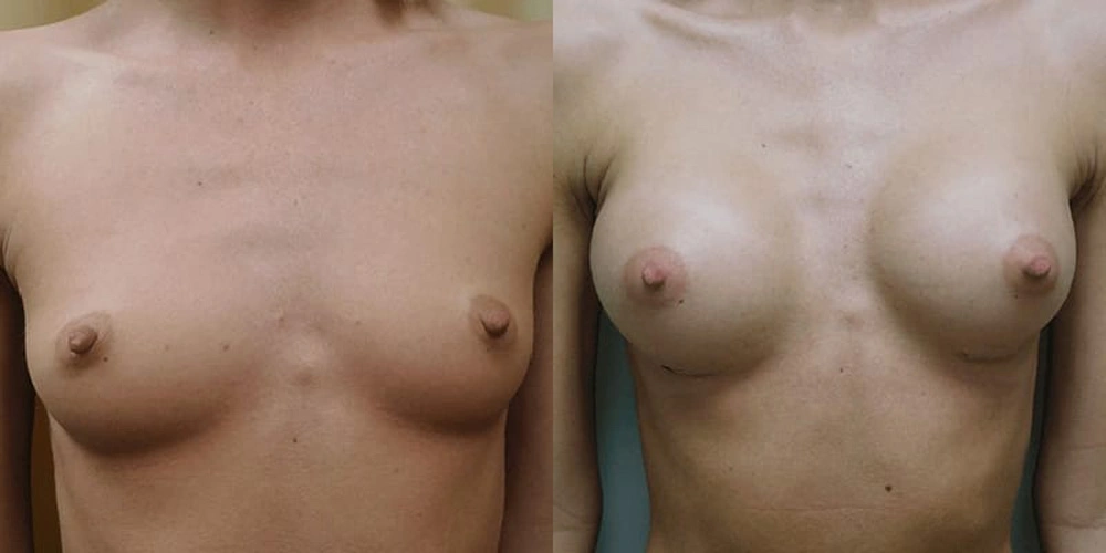 Real patient results in Owings Mills, MD Performed by Steven J. Rottman MD
