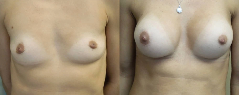 Real patient results in Owings Mills, MD Performed by Steven J. Rottman MD