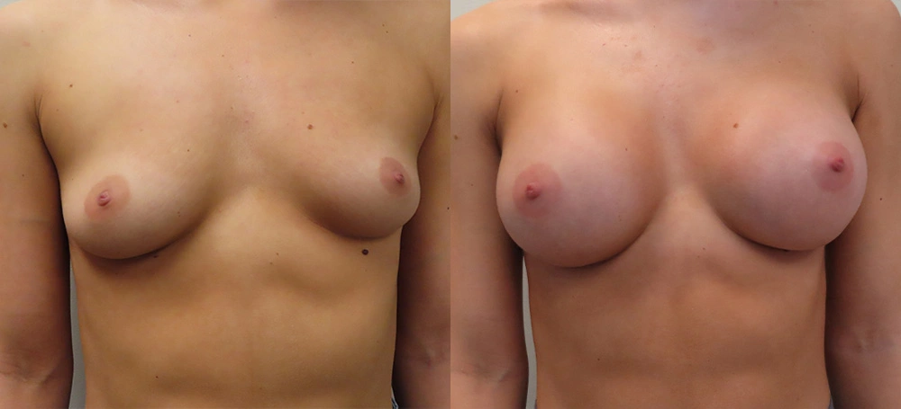Real patient results in Owings Mills, MD Performed by Steven J. Rottman MD