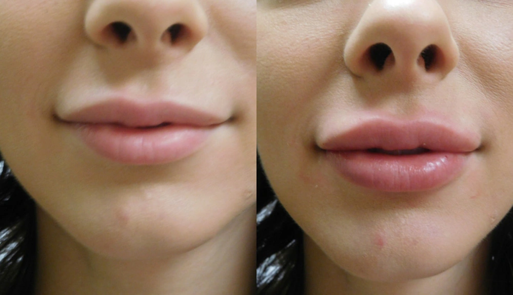 Real patient results in Owings Mills, MD Performed by Steven J. Rottman MD