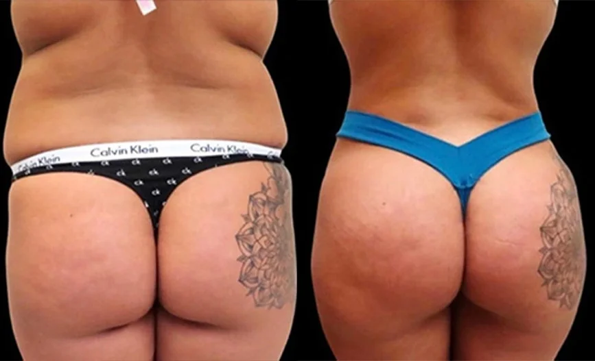 Real patient results in Owings Mills, MD Performed by Steven J. Rottman MD