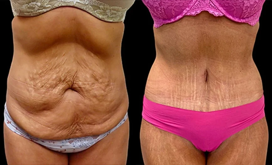Real patient results in Owings Mills, MD Performed by Steven J. Rottman MD