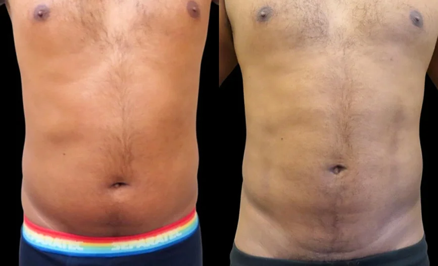 Real patient results in Owings Mills, MD Performed by Steven J. Rottman MD