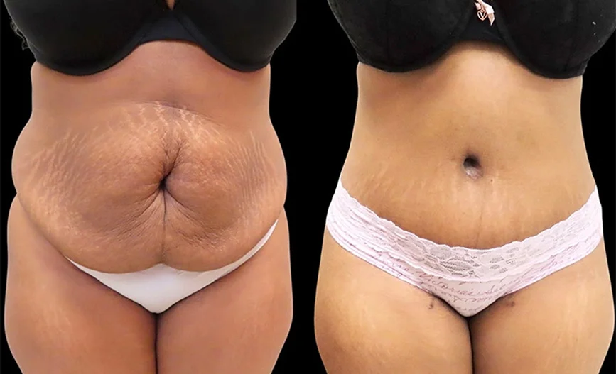 Real patient results in Owings Mills, MD Performed by Steven J. Rottman MD