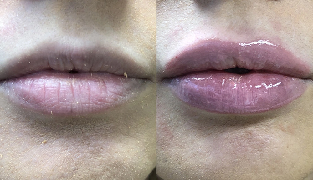 Real patient results in Owings Mills, MD Performed by Steven J. Rottman MD