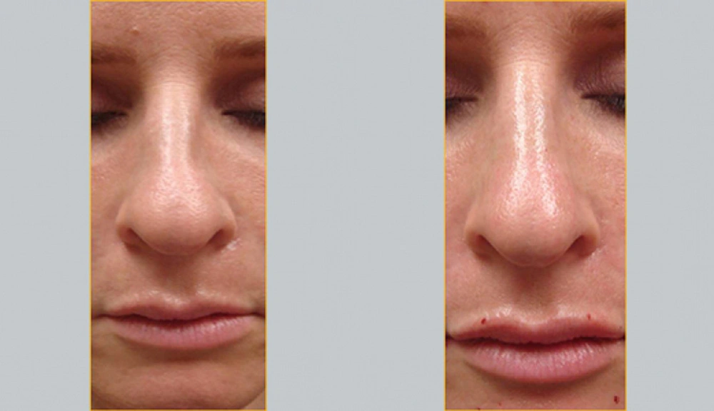 Real patient results in Owings Mills, MD Performed by Steven J. Rottman MD