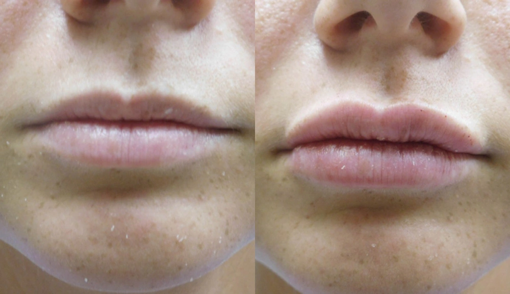 Real patient results in Owings Mills, MD Performed by Steven J. Rottman MD