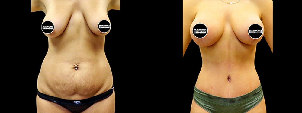 Real patient results in Owings Mills, MD Performed by Steven J. Rottman MD