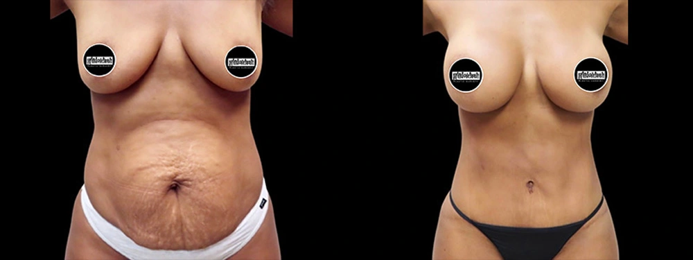 Real patient results in Owings Mills, MD Performed by Steven J. Rottman MD