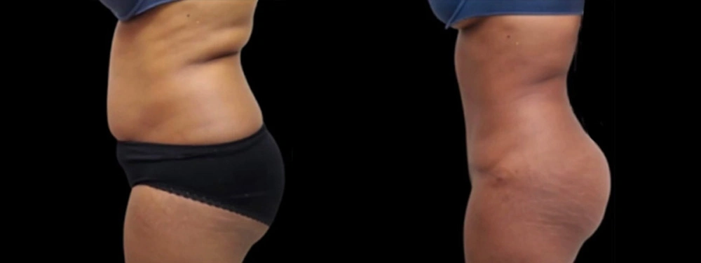 Real patient results in Owings Mills, MD Performed by Steven J. Rottman MD