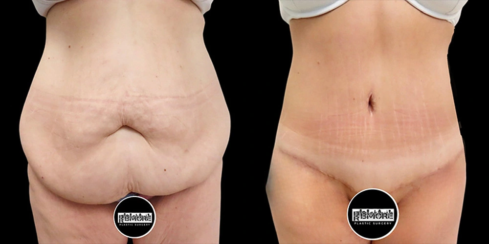 Real patient results in Owings Mills, MD Performed by Steven J. Rottman MD