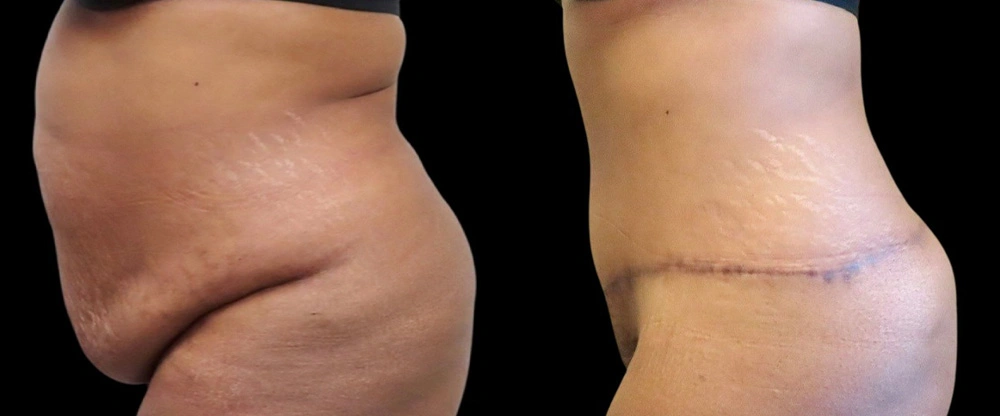 Real patient results in Owings Mills, MD Performed by Steven J. Rottman MD