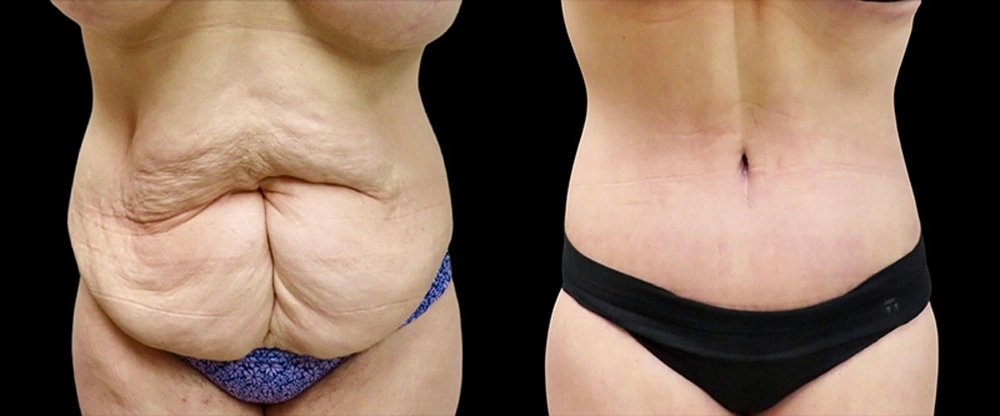 Real patient results in Owings Mills, MD Performed by Steven J. Rottman MD